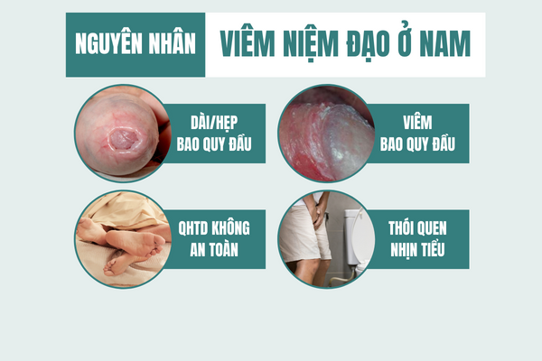 Dung-xem-nhe-viem-nieu-dao-o-nam-2