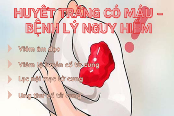 Huyết trắng có máu – Bệnh lý nguy hiểm tiềm tàng