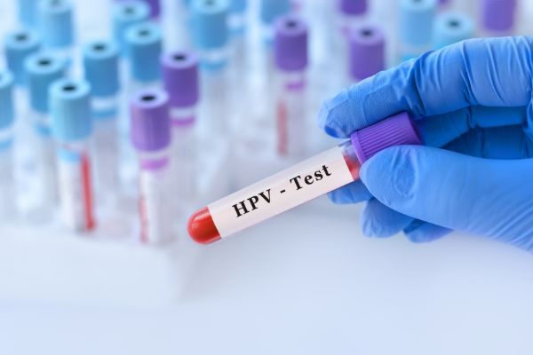 Chi phí kiểm tra HPV thường không cao và phụ thuộc vào nhiều yếu tố