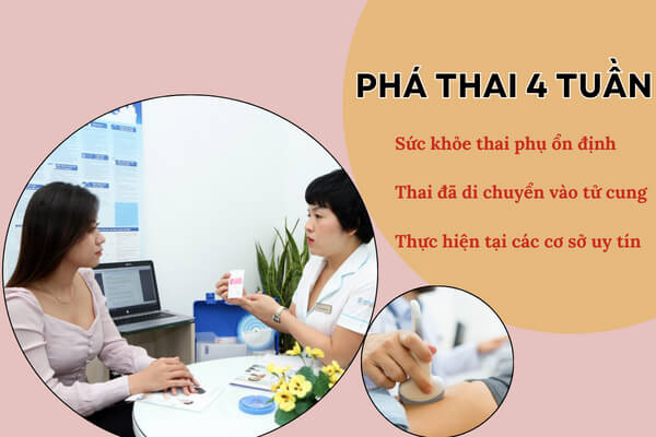 Thực hiện phá thai 4 tuần an toàn như thế nào?