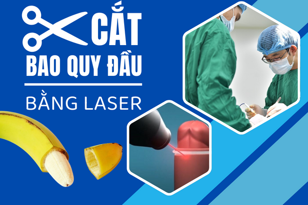 Phương pháp cắt bao quy đầu bằng laser.