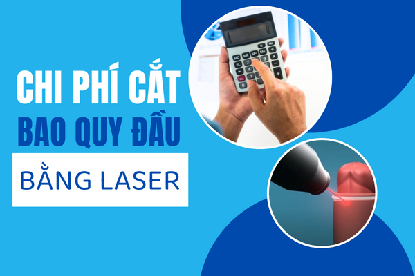 Phuong-phap-cat-bao-quy-dau-bang-laser-1