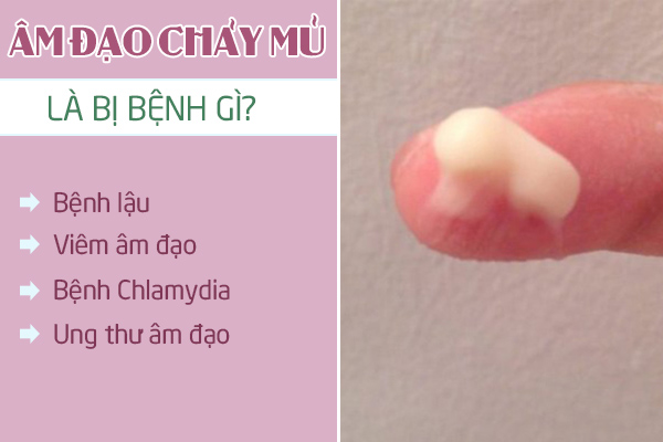 Am-dao-chay-mu-1