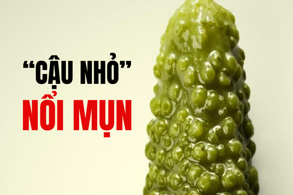 Cảnh báo tình trạng “cậu nhỏ” nổi mụn.