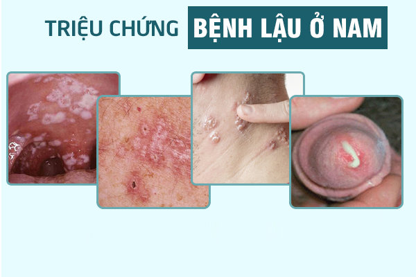 Duong-vat-chay-mu-5