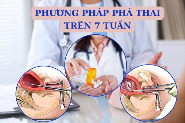 Các phương pháp phá thai trên 7 tuần được áp dụng hiện nay