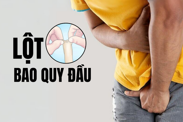 Thế nào là lột bao quy đầu an toàn?