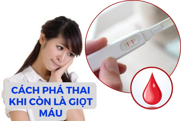 Phương pháp phá thai khi còn là giọt máu an toàn, hiệu quả