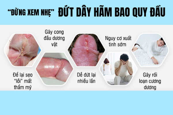 Dut-day-ham-bao-quy-dau-1