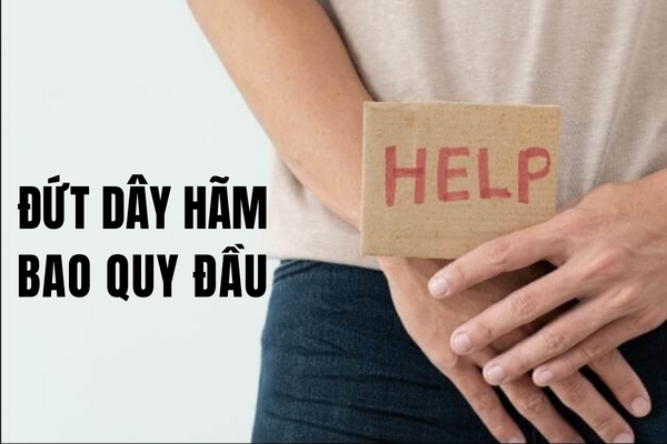 Đứt dây hãm bao quy đầu – Thông tin cần biết để điều trị an toàn.