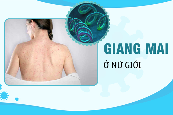 Triệu chứng giang mai ở nữ – Ảnh thực tế qua từng thời kỳ 