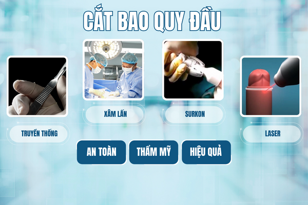 Goi-y-dia-chi-cat-bao-quy-dau-uy-tin-1