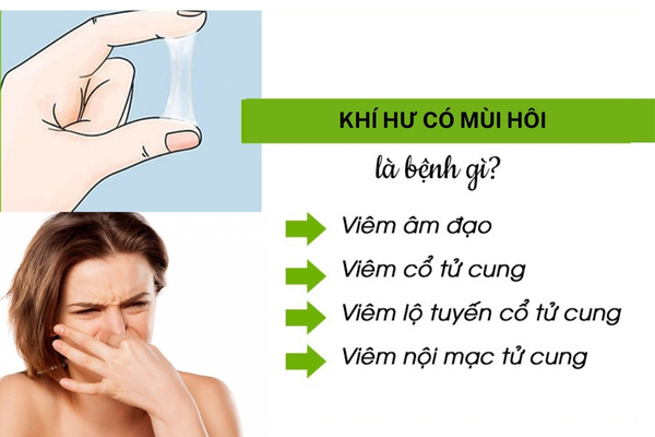 Khí hư có mùi hôi là bị bệnh gì?